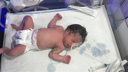 In this video, we show the careful stomach wash procedure for a newborn baby in the NICU. This step is performed to clear the baby’s stomach and ensure proper care during critical treatment. Every action is done with gentleness and medical supervision to support the baby’s recovery. #NICUBaby #NewbornCare #StomachWash #NICUJourney #CriticalCare #PrematureBaby #NICUlife #NICUNurses #BabyCare #littlefighter2 | Gautam Ashish