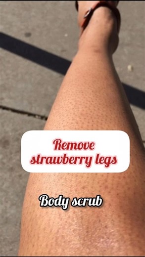 DIY Scrub to FIX Strawberry Legs 🍓✨ (3 Ingredients!) #shorts