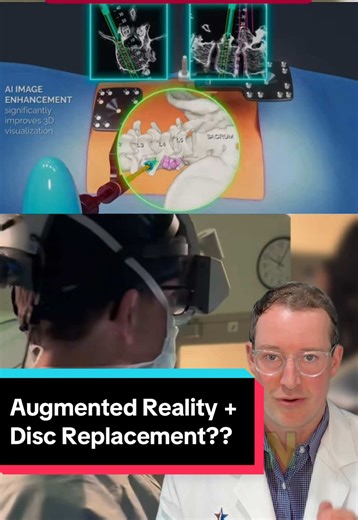 2026 spine technologies I’m excited about: Disc Replacement Augmented Reality 🚀🦴 Spine surgery isn’t static—anatomy shifts with positioning, breathing, and correction. Augmented Reality helps account for real-time anatomical displacement, so what I see matches what’s actually happening in the operating room. When millimeters matter, precision matters. I’m excited to push the field forward, combine advanced technologies, and continue delivering the best care possible to my community. #SpineSurg