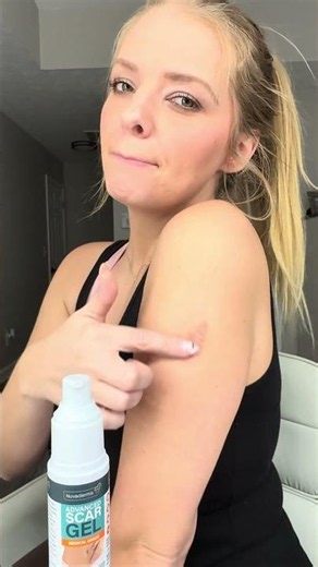 Nuvadermis Advanced Scar Gel Review - Retinol + Vitamin E for Scar Fading