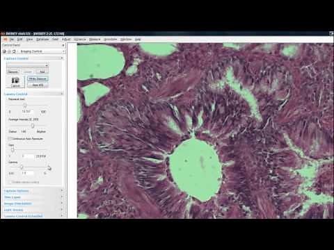 Lumenera INFINITY ANALYZE Introduction & Overview Tutorial