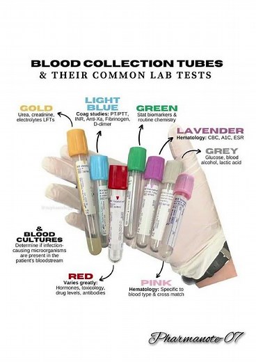 Blood collection tubes in commonly use to lab tests