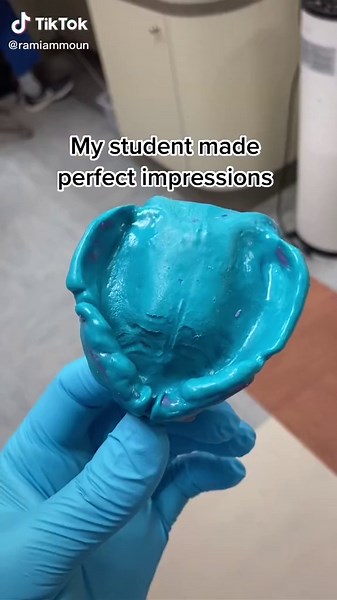 Effective Edentulous Impressions for Denture Patients