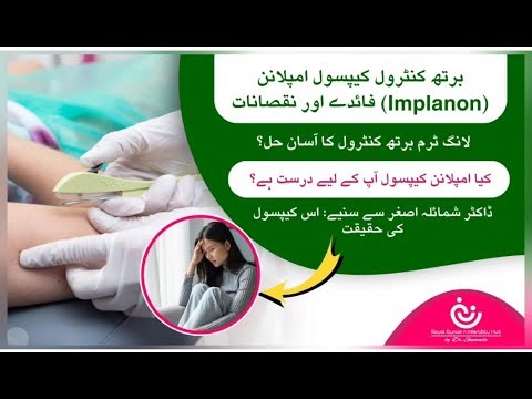 Implanon Capsule for Women | Birth Control Implant, Side Effects, Duration & Safety