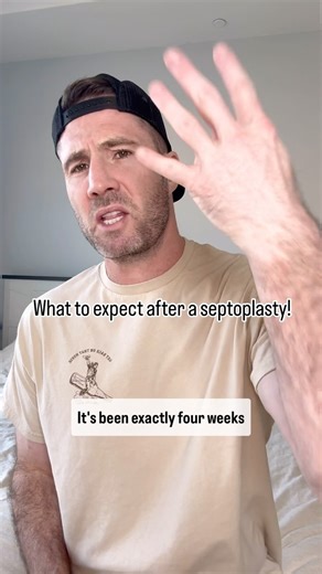 Dr. Joe, M.D. on Instagram: "This was basically what I experienced after getting my septoplasty done four weeks ago. Obviously there could be a lot more details, but the video would be too long. If you need to have the surgery done and have any questions about my experiences, ask in the comments and I will do my best to respond. #septoplasty #nasalcongestion #breathingproblems"