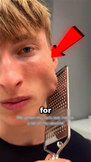 Bro used a cheese grater for jawline.