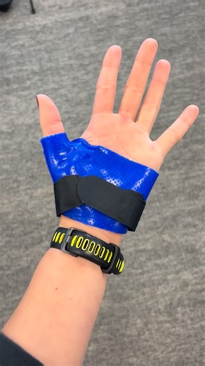 Gianna Taffo, OTD, OTR/L on Instagram: "If gripping, pinching, or texting hurts.. this splint may help 👍 A thumb spica supports the thumb joints while letting the rest of your hand function normally. Often used for thumb tendon irritation and arthritis Not all thumb pain needs a full cast 👀 Shoutout to CHT @jambro923 for her demo 🤌🤌 #occupationaltherapy #handtherapy #thumbpain #rehab #splinting"