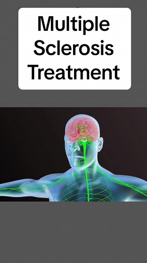 Understanding Multiple Sclerosis Causes and Copaxone Treatment
