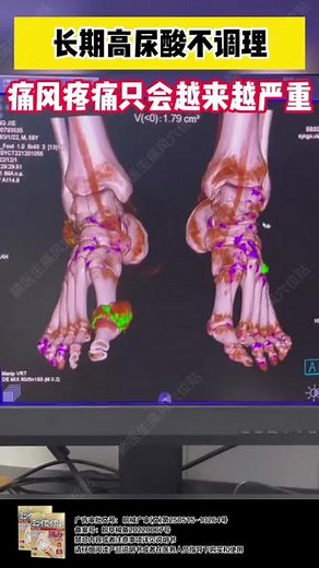 请大数据推荐给有需要的人吧！这款真的是太棒了