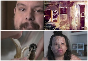 Human Toll of Honey Oil Drug Lab Explosions Highlighted In Emotional New RivCo DA Campaign