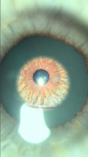 Zooming Into the Human Eye 👁️