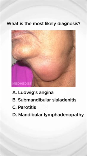 follow for more 🩺 on Instagram: "Answer in poll⤵️"