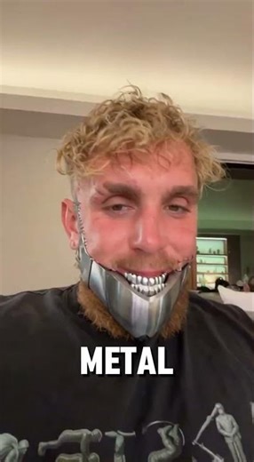 Jack Paul's new ironjaw is terrible #metaljaw