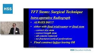 Revision Femoral Implant Choices