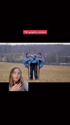 The tragic life of Masha and Dasha #russia #truecrime #truecrimetiktok #truecrimecommunity #crimetok #medical #torture #disturbing #fyp