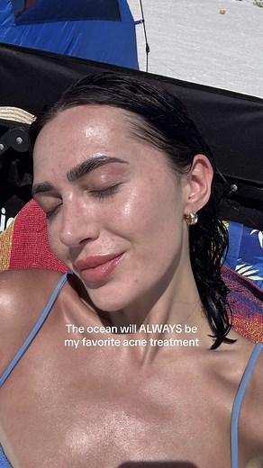 Ocean as Acne Treatment: Myth or Miracle?