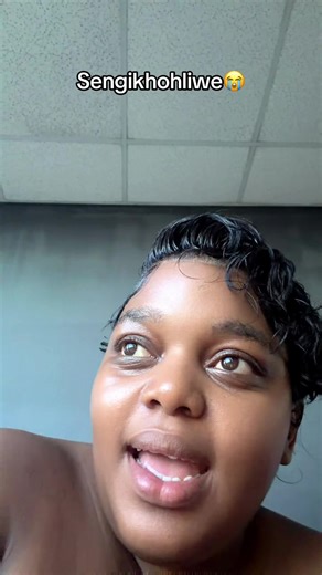 Understanding Stretch Marks and Skin Care Tips