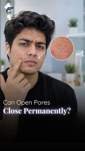 Can Open Pores Close Permanently? | The Truth About Acne Pores Explained Dr. Vijay Soyal, MD