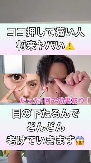 【ココを押して痛い人は将来ヤバい⚠️】目の下がたるんで、どんどん老けていきます😱#目の下のたるみ #目のたるみ #目の下のクマ #目元のたるみ