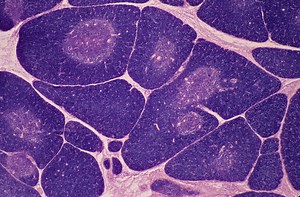 Dear Doctor: Do intra-mammary lymph nodes pose a risk?