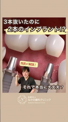 Three teeth removed, but two implants!? Is it really okay? #NakanoDental #OkayamaDentist #Implant...