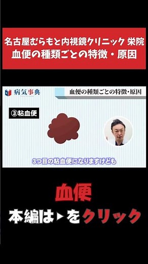 【血便】特徴・原因は？ 血便に潜む病気を内視鏡専門医が解説 #大腸がん #病気 #血便