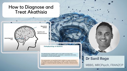 Akathisia - Pathophysiology, Diagnosis and Management Strategies