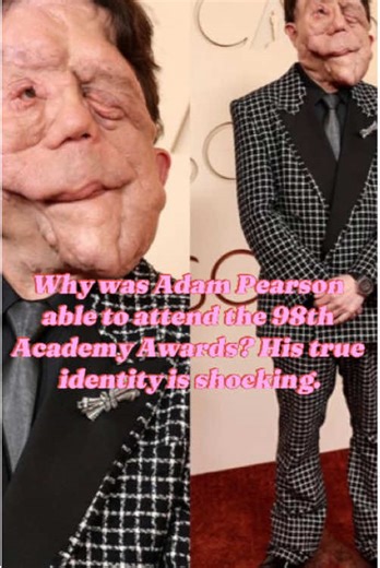 Adam Pearson at the 98th Academy Awards: His Shocking Identity