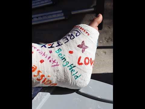 Short Leg Cast – Process-Based Art Project | Plaster Cast Experience