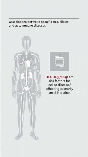 What is the role of Human Leukocyte Antigens (HLA) in disease research?