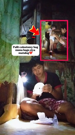 256K views · 12K reactions | Colostomy bag❤ #daughter #trendingreelsvideo | Dondon Tecson Havana | Facebook