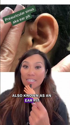 Ever Notice a Tiny "Hole" Near Someone's Ear?