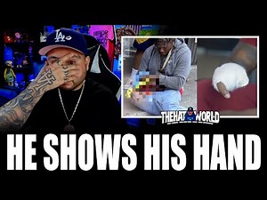 4xtra Finally Shows His Hand After Fireworks Accident… This Changes Everything