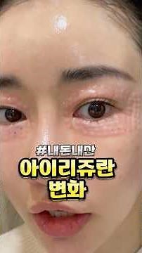 Rejuran Healer Eye Skin Elasticity and Wrinkle Change Review! Rejuran Eye,