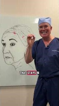 Dr. Claytor Explains the ENDOSCOPIC Brow Lift Using Endotines | Claytor Plastic Surgery