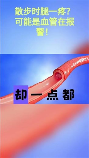 散步时腿一疼？可能是血管在报警！ #健康养生 #科普 #健康习惯 #药膳 #https #中國醫 #分享 #感情 #藥品