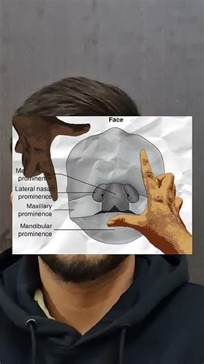 Cleft Lip and Palate. Hypernasality And Velopharyngeal Insufficiency causing this speech defect