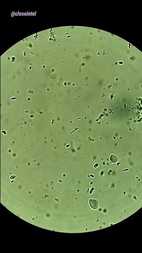 Raw Kombucha Tea Under Microscope