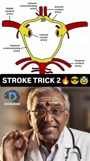 Dr Kailasam | TRICKS FOR STROKE 2🥸😌😎🔥 See students… this one drawing trick will make stroke territories unforgettable! P for PCA (visual loss), M for... | Instagram