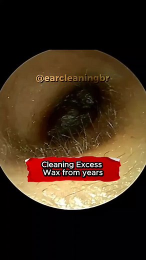earcleaning on TikTok