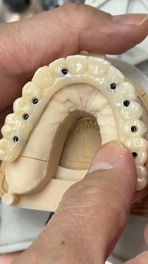 202K views · 472 reactions | Temporary PMMA Implant! Case from Dr. Olga Krikunenko in Massachusetts! EnvisionTEC Mint Dental of Franklin | Luke Kahng | Facebook