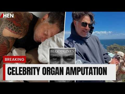 Joe Manganiello Reveals Life-Threatening Health Battle and Amputation