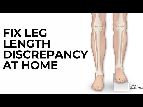 One leg shorter than the other? Leg length discrepancy exercises to fix it.