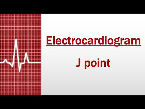 J Point [Electrocardiogram]