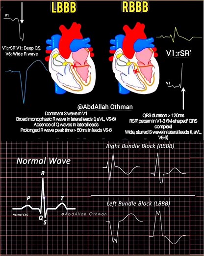 124K views · 957 reactions | A clear visual guide to differentiating...