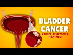 Bladder Cancer – Causes, Signs and Symptoms, Diagnosis & Treatment