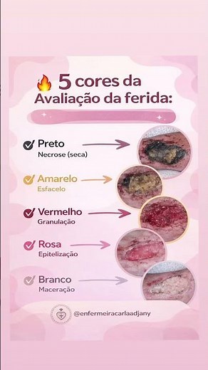 Você sabe fazer a avaliação de uma ferida para realizar um ótimo curativo