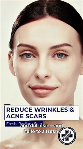 Glow From Within with PRP Skin Rejuvenation ✨ #PRPTherapy #SkinRejuvenation#shortvideo #trending