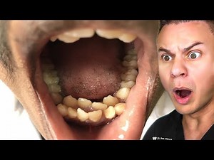 Orthodontist Reacts To The WEIRDEST Teeth On TikTok