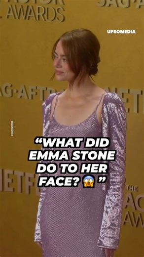 Emma Stone's new face has everyone talking 🫢 | Celebrities